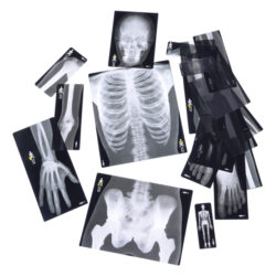 human body x-rays